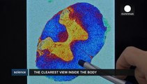 Powerful MRI scanners could predict diseases