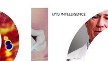 Philips EPIQ premium ultrasound system