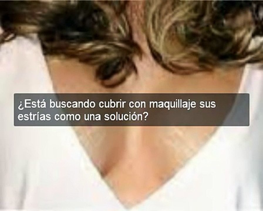 Como Quitar Las Estrias Blancas Rápido  