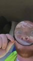 Guy Burns Unsuspecting Friend With Magnifying Glass And His Reaction Is Priceless