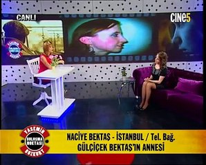 Estetik İle Büyük Değişim Bölüm 2