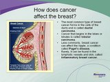 Unknown Signs and Symptoms of Breast Cancer