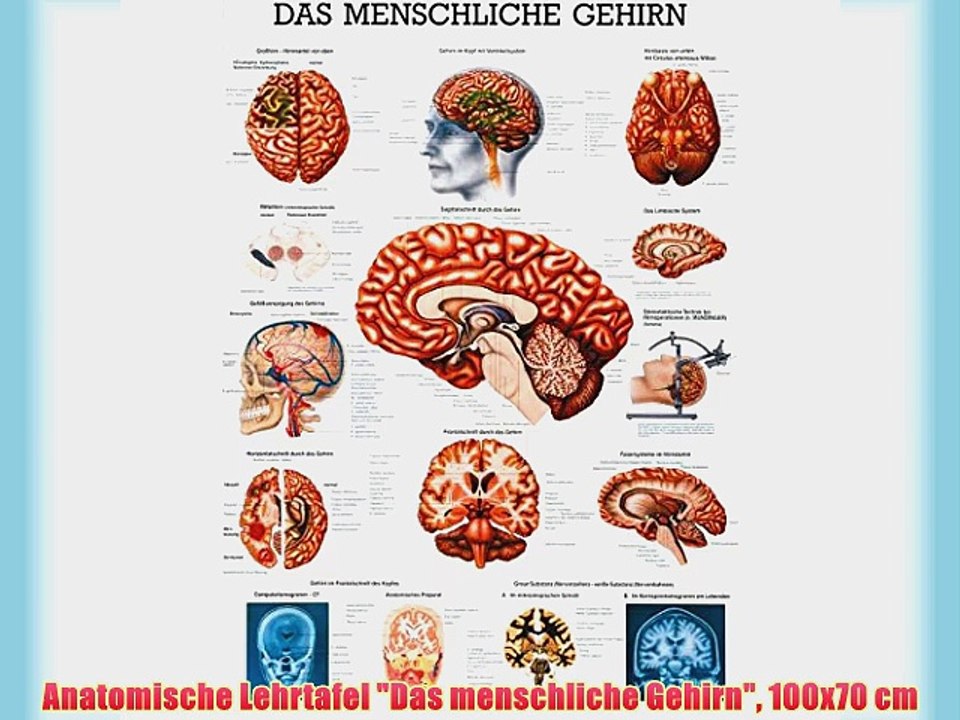 Anatomische Lehrtafel Das menschliche Gehirn 100x70 cm