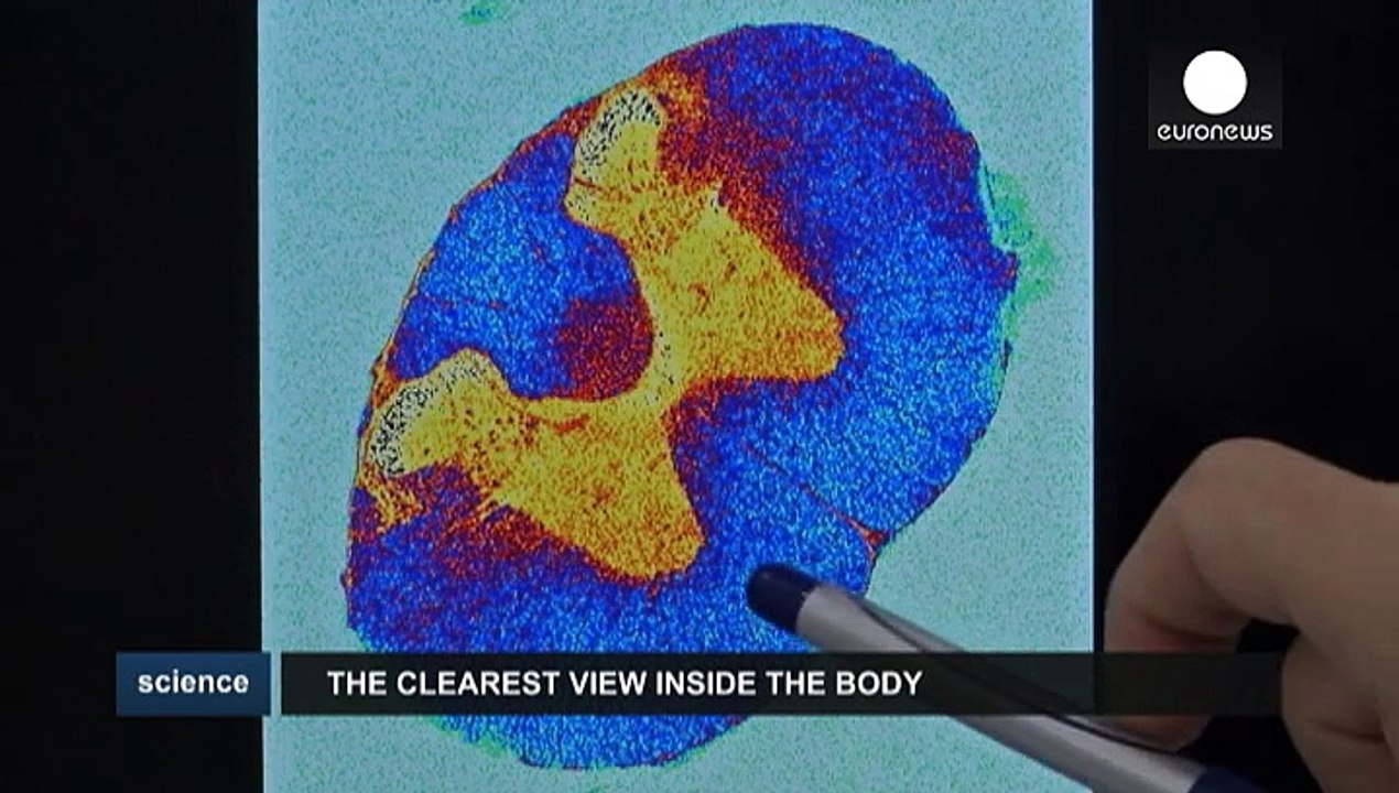 Neuer magnetresonanztomograph im forschungszentrum in lissabon