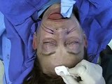Minimally-Invasive Facial Rejuvenation: Techniques in Aesthetic Plastic Surgery (Elsevier)