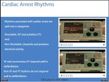 Advanced Life Support Shockable and Non Shockable Rhythms.