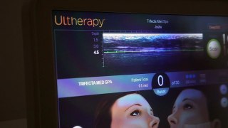 How Ultherapy Works