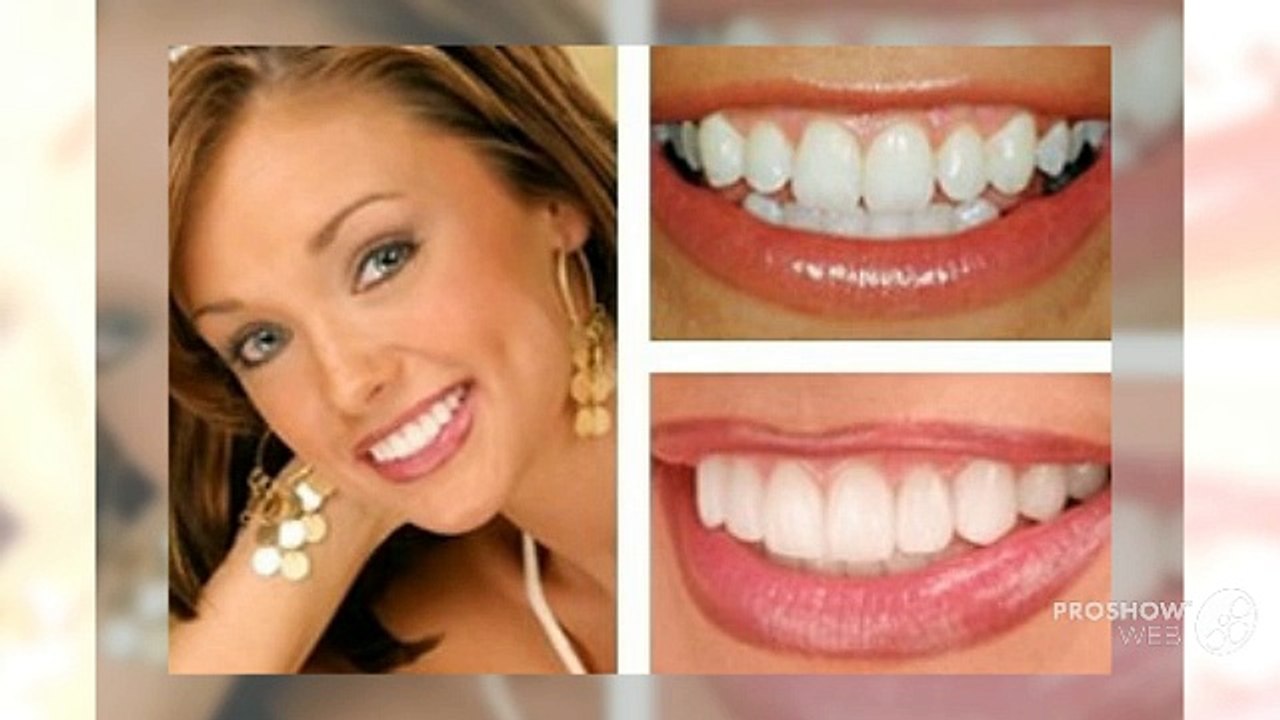 Dental Implant Charlotte