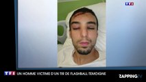 Témoignage glaçant d'un jeune homme blessé par le tir de Flash-Ball d'un policier