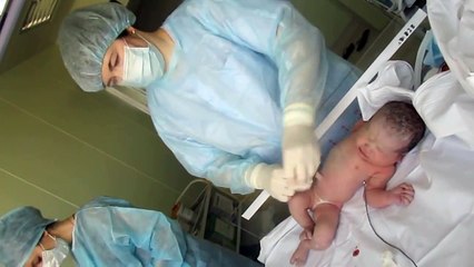 Осмотр и обработка ребенка после кесарева сечения