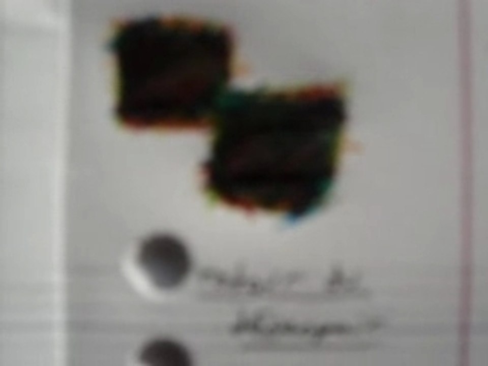 Ma souffrance