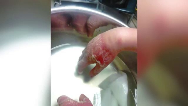 Elle trouvait la plante jolie, elle a voulu la toucher et elle n'aurait pas du!