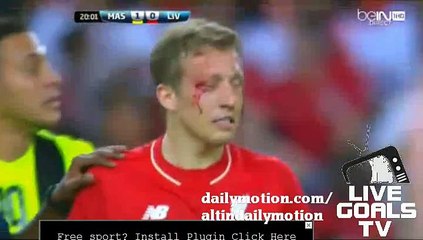 Lucas Leiva Injured Eyes | Malaysia 1-0 Liverpool