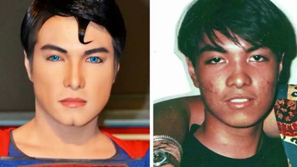 Joven se somete a 23 cirugías para parecerse a Superman