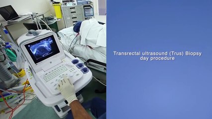 Transrectal ultrasound (Trus) Biopsy of the prostate