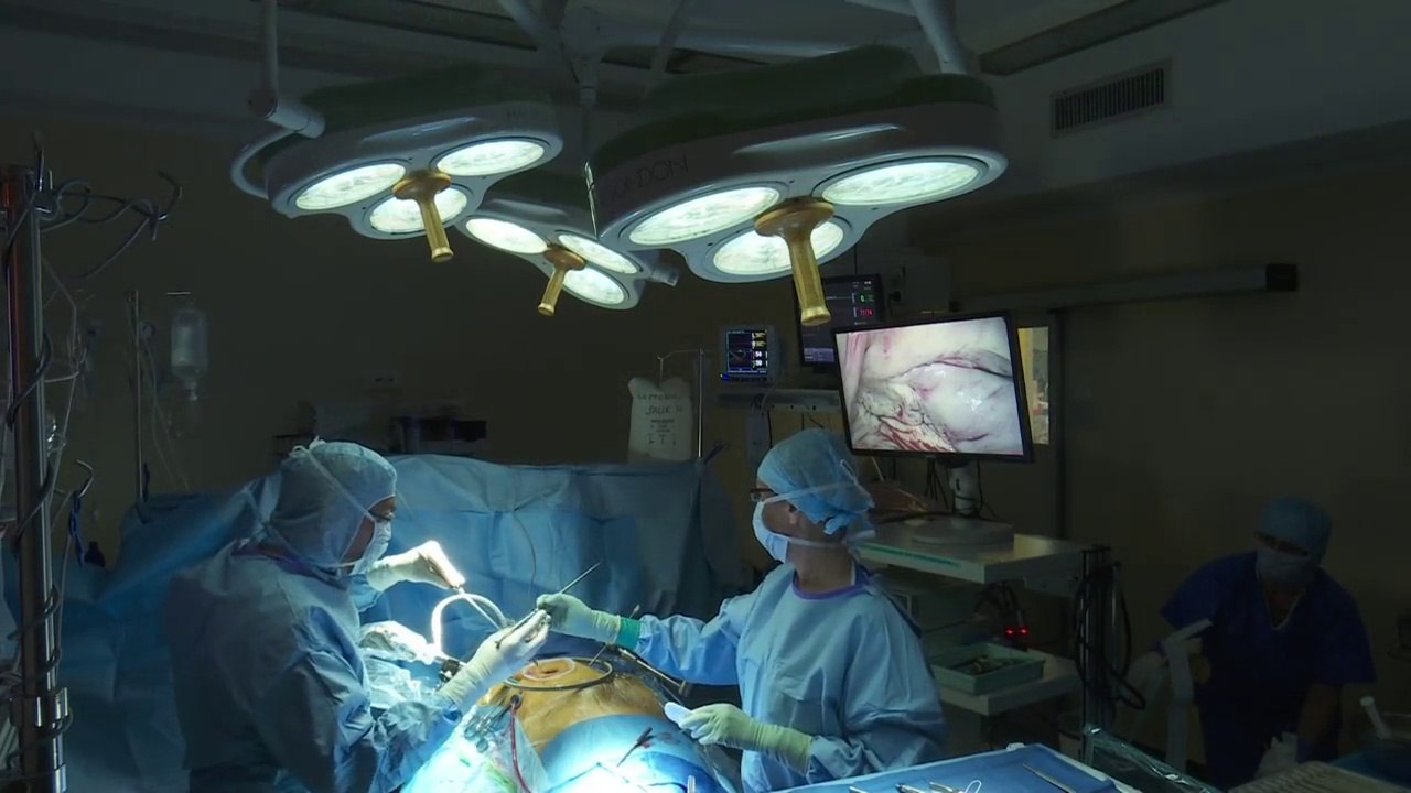 Remplacement valvulaire mitral mini-invasif sans cicatrice/Dr Doisy