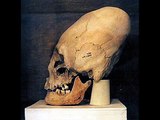 Confirmation that Elongated / Conehead skulls from Peru and elsewhere are extraterrestrial fossils!