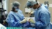 Rhinoplasty Surgery by San Diego Facial Plastic Surgeon