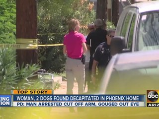 Police arrest man who had cut off his arm, gouged out his eye