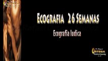 Ecografia 4D embarazo de 26 semanas  manos y pies  4D Dr.Rafael Ortega Muñoz Ciudad Real  Spain
