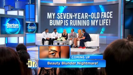 Large Facial Tumor Removal, Parotid Gland: The Doctors TV Show