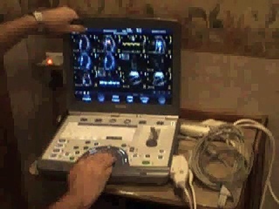 Academy of Ultrasound, LLC Video I.avi