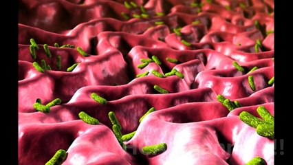 HELICOBACTER PYLORI SINTOMAS DIAGNOSTICO TRATAMIENTO Y PREVENCION
