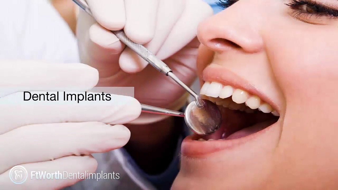 Choosing The Right Dentist For Your Dental Implants