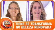 Tiene se transforma no Beleza Renovada