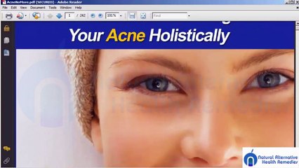 Acne No More Review - NO ACTORS USED! _ ANM Is Not A Magic Pill!
