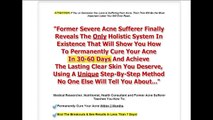 Get Rid of Acne in 7 days with Acne No More - My Honest Review!