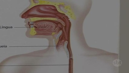 Especialistas falam sobre os sintomas e tratamento do refluxo