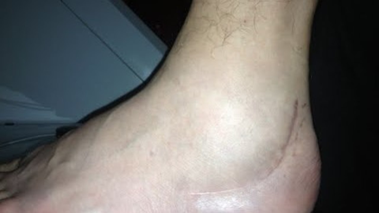 My shattered heel!