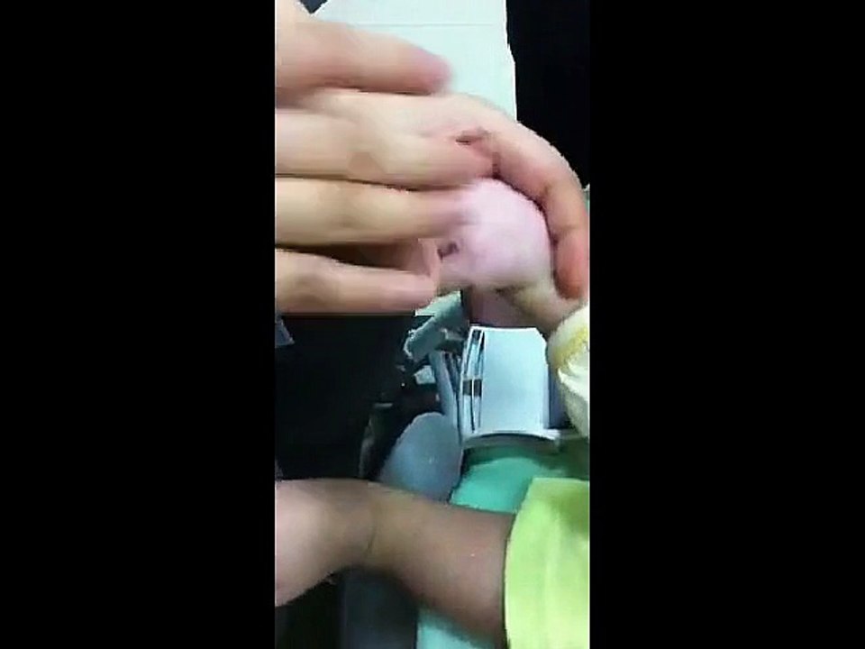 DIY 小儿推拿 (13) 厌食调理与促进血液循环