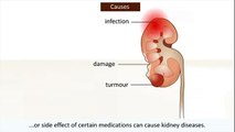 Kidney Disease and Kidney Failure : Signs & Symptoms of Kidney Disease and Treatment Options