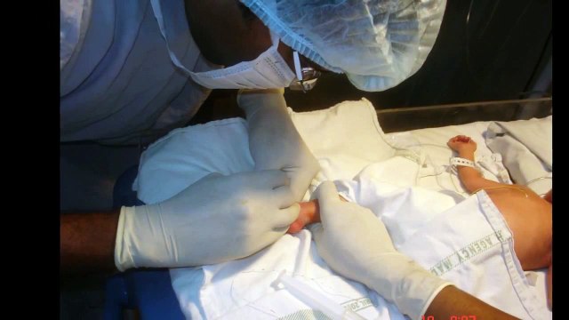 Peripherally Inserted Central Catheter (PICC line) Insertion