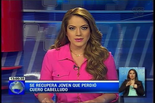 Se recupera joven que perdió cuero cabelludo