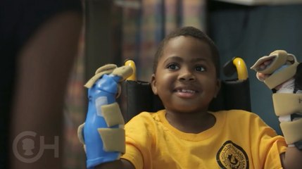 Première mondiale : un enfant de 8 ans greffé des mains