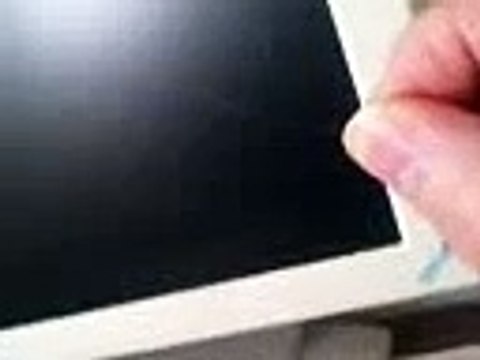 Unknown Flying Parasite Worm Morgellons