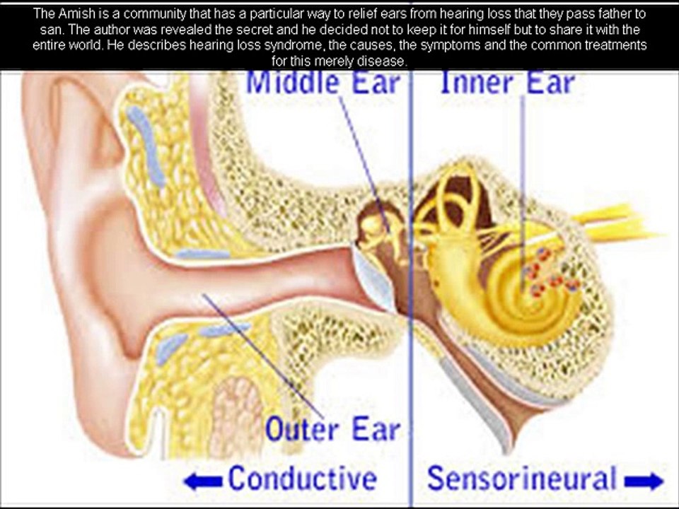 Hearing loss Reversed review