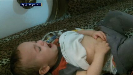 تفشي التيفوئيد في الأحياء الجنوبية من دمشق