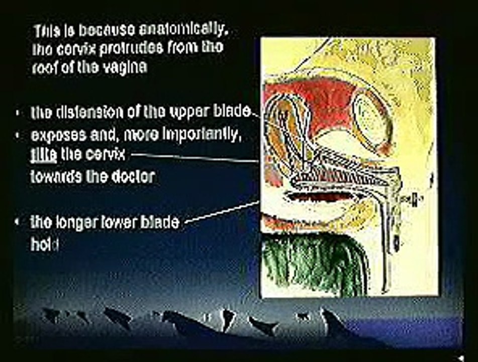 Features of the Leespec