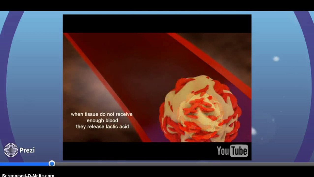 severe sepsis and septic shock