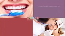 Teeth Whitening Provided By Dentists In Ft Worth