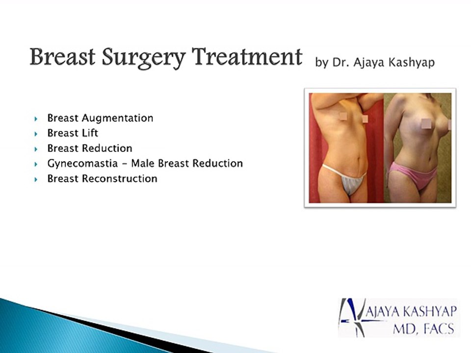 Face Lift Surgery, Nose Surgery, Tummy Tuck in Delhi - www.drkashyap.com