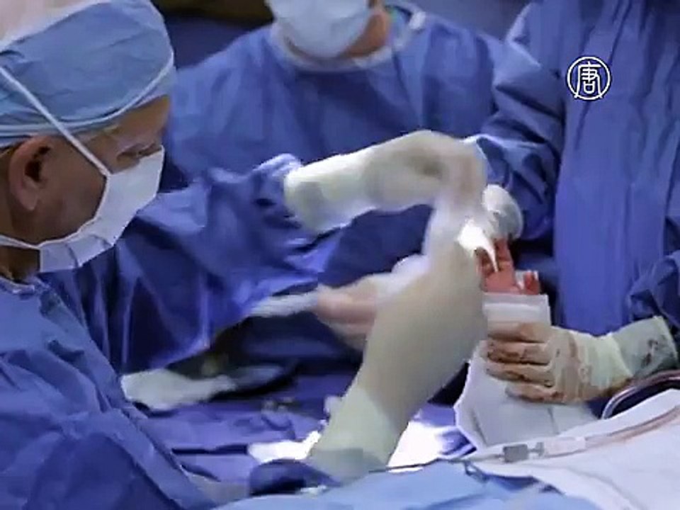В США 8-летнему мальчику пересадили кисти рук