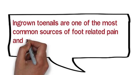 Ingrown Toenail Surgeon Utah
