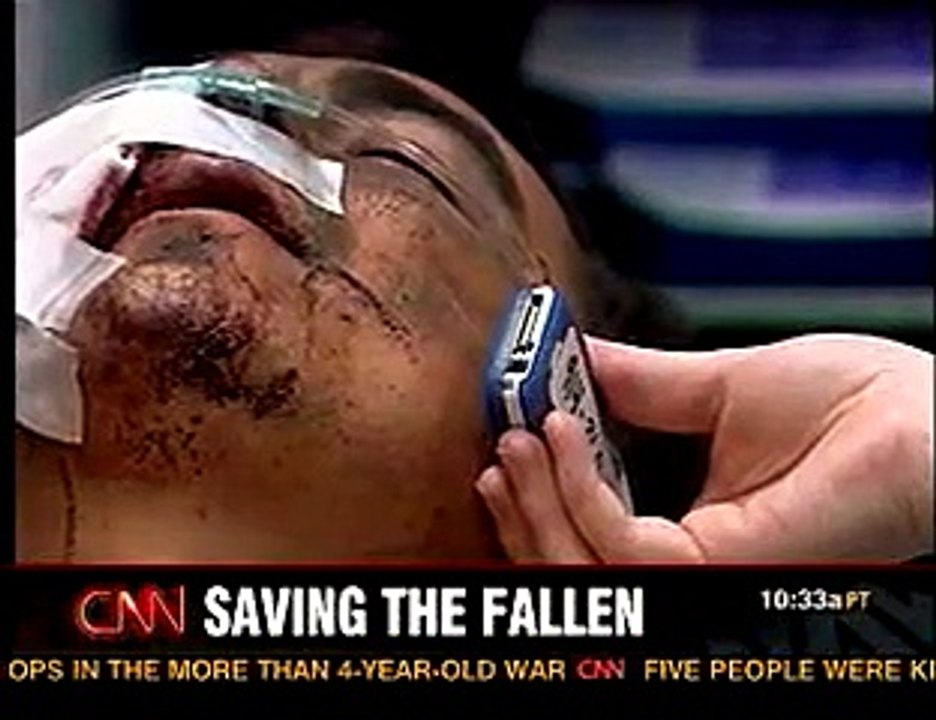 CNN Combat Hospital Music Video (Coldplay)