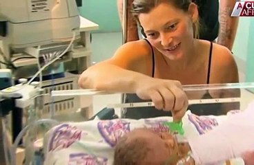 Australian Conjoined Twins Faith And Hope Die After A 'Miraculous' 19 Day Life