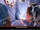 México realiza con éxito, primer trasplante de corazón artificial
